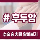 후두암