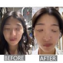 민에스테틱화장품 | 대구 남구 에스테틱 맞춤 수기 윤곽관리 민레스트