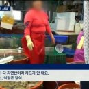 스킨지키미