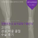 창인 메디칼 | 고양이 경골/비골 골절 수술 후기 ( 물금동물병원 / 물금24시동물병원 / 밀양24시동물병원)