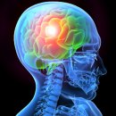 서울브레인신경과의원 이미지