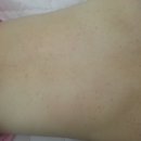 이소메디칼 이미지