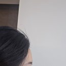 유앤미의원 | 이마 필러 유앤미의원 방문 후기 │ 줄기세포 베베필로 자연스러운 이마 볼륨 케어 내돈내산 3일차 솔직...