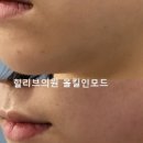 힐리브의원 이미지