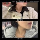 뽀샵 - 창원시 의창구 사림로 118 | [더빛날 에스테틱] 뽀샵턱 1회차 내돈내산 후기 온다리프팅