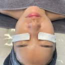 구안컨설팅 | [제주-연동] 제주 피부관리 '4u에스테틱' 피부 면역관리 후기