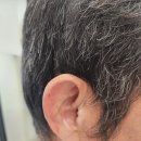 (주)독일보청기 | 소음성 난청, 한쪽 보청기 착용 - 주OO님 후기