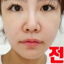 번영로R | 산본피부관리 경락 맛집 시절에스테 방문후기