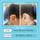맑은소리보청기 네이버블로그
