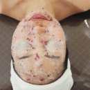 현지피부관리