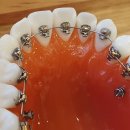 스마일준치과의원 이미지