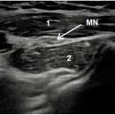 명작한의원 이미지