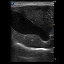 엔도소노 이미지