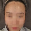 이슈플래닝 | 춘천 피부웨딩관리 맞춤관리 <뷰티오로라엘 본점> 광채플래닝 후기💜