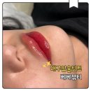 도구로3길 24 | 대구입술 틴트 받고 달라진 생얼｜칠곡 베베뷰티 5일차 리얼 변화