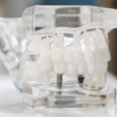 승원치과의원 이미지