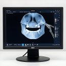 덴탈스케치치과기공소 | 앗, 내 치아 상태? 진심으로 현타 왔던 썰 푼다