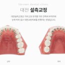 서울브라운치과 이미지