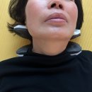 발상코퍼레이션 넥가드닥터NG100 시원하게 목스트레칭 해요