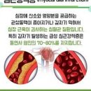 심근경색 원인 증상 예방법 알아보자 이미지