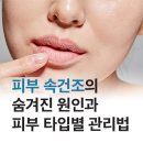 톡스앤필의원 원주점 네이버블로그