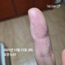 자연요법 | GAPS 만성질환 자연치료 식이요법 갭스 (GAPS diet)실천 후기
