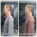 단풍나무짐 이미지