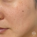 돌콩PC | EGF화장품 에포나 리부트 듀얼 이펙트 톡스 세럼 후기