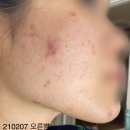 통일약국 | 파티온 노스카나인 트러블 제품 후기