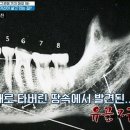 서넥스 네이버블로그