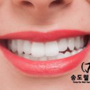 연수웰치과 이미지