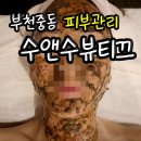 수앤수 피부 | 부천 중동 피부관리_ 문제성 피부 전문 수앤수뷰티끄에서 플라즈마 알라딘필링 받고 온 후기