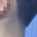 김해내동피부과 한방진료 급성 만성 둘다 주목할 것