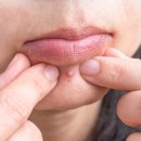 포이즌의원 이미지