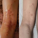 미추홀해독센터 | 얼굴빛 환하게, 탄력 되살리는 비결! ✨