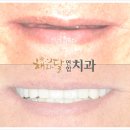 해와달연합치과 이미지