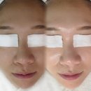 노원피부관리 잘하는 곳 스킨글림 재방문 세라비비먼트 후기