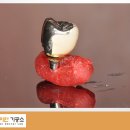 다이안치과기공소 이미지