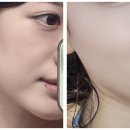 타임피부관리