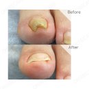 다시온 리케어 이미지