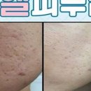 미엘피부관리