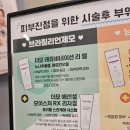 강남 다리 레이저제모 가격 종아리제모 추천 후기 유스타일9의원