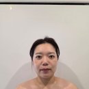 더 H 콘서트(다이아) | 첨단윤곽관리 다이아뷰티｜출산 후 처진 피부 1:1 홀리스틱 리프팅 후기