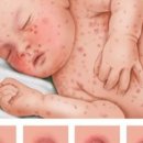 팍스치킨 이미지