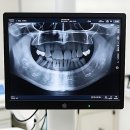 금광의료기기 | 이거 진짜 안 미루길 잘했다! 내 이