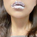 부산입술필러 추천 서면 입술필러 내돈내산 후기 @자연스러운 입술 대만족 [광고X]