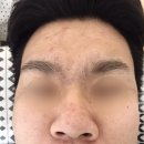 (주)토탈에이플러스 | 수원고색동_살롱드쉬 MTS 모공 흉터 미백 재생 피부...얼굴전체왁싱 시술 잘하는샵･ᴗ･ (가격 후기)