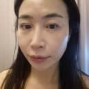 더끌림 | 송도 피부관리 추천｜더끌림스킨 애씨큘 관리 재방문 후기