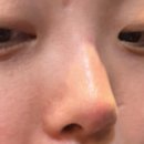 슈가티코(주) | 부산경성대 코필러맛집 코필러잘하는곳 추천 내돈내산후기
