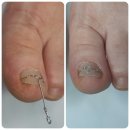 레푸스 감삼점&에이레네 이미지